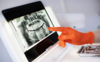 Implantes Dentales Marfil Den