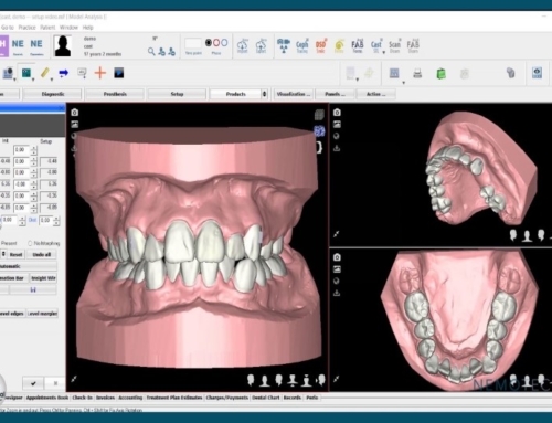 ¿Funciona Invisalign para resolver el apiñamiento dental?