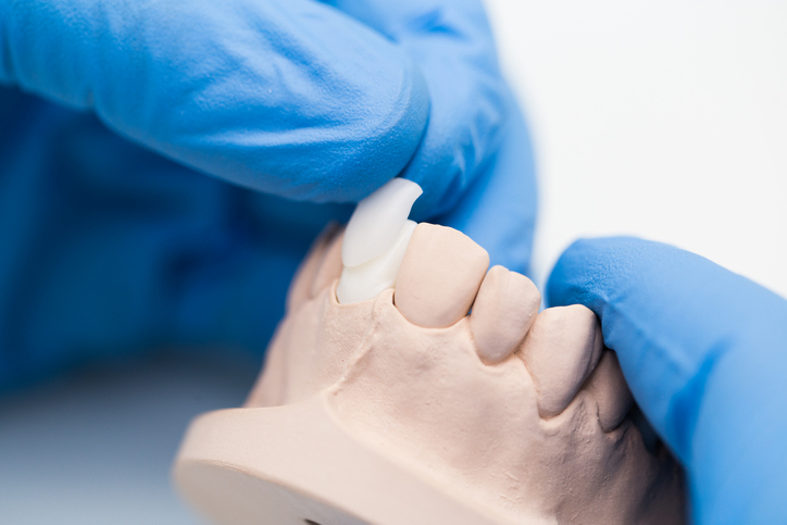 Close up shot of dentist's technician's hands working on a prosthetic tooth, measuring the crown of a tooth.