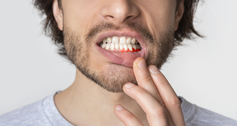 Man suffering from toothache, tooth decay or sensitivity